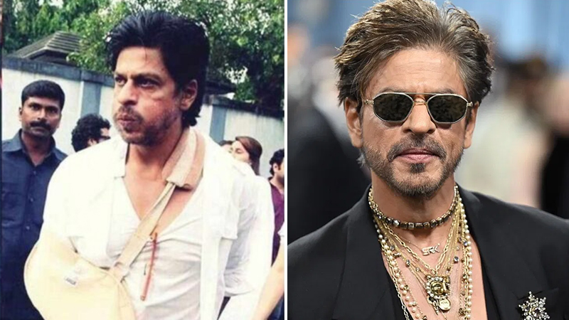 Shah Rukh Khan injured during shooting